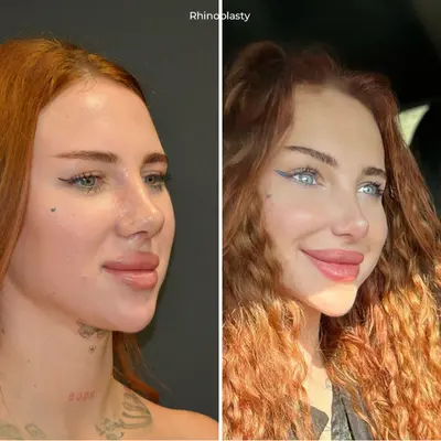 before-after (12)