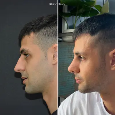 before-after (14)