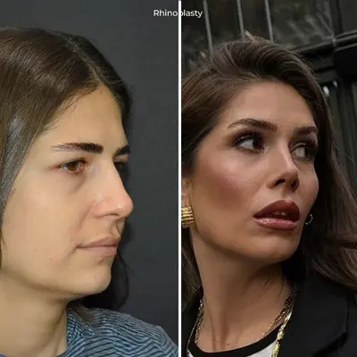 before-after (17)