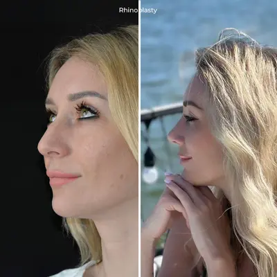 before-after (18)
